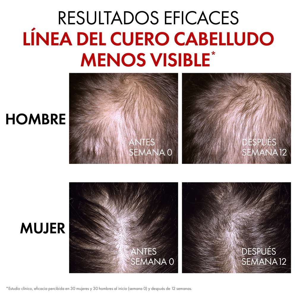 VICHY Dercos Serum Aminexil Regen Booster X 90 Ml - Image 5