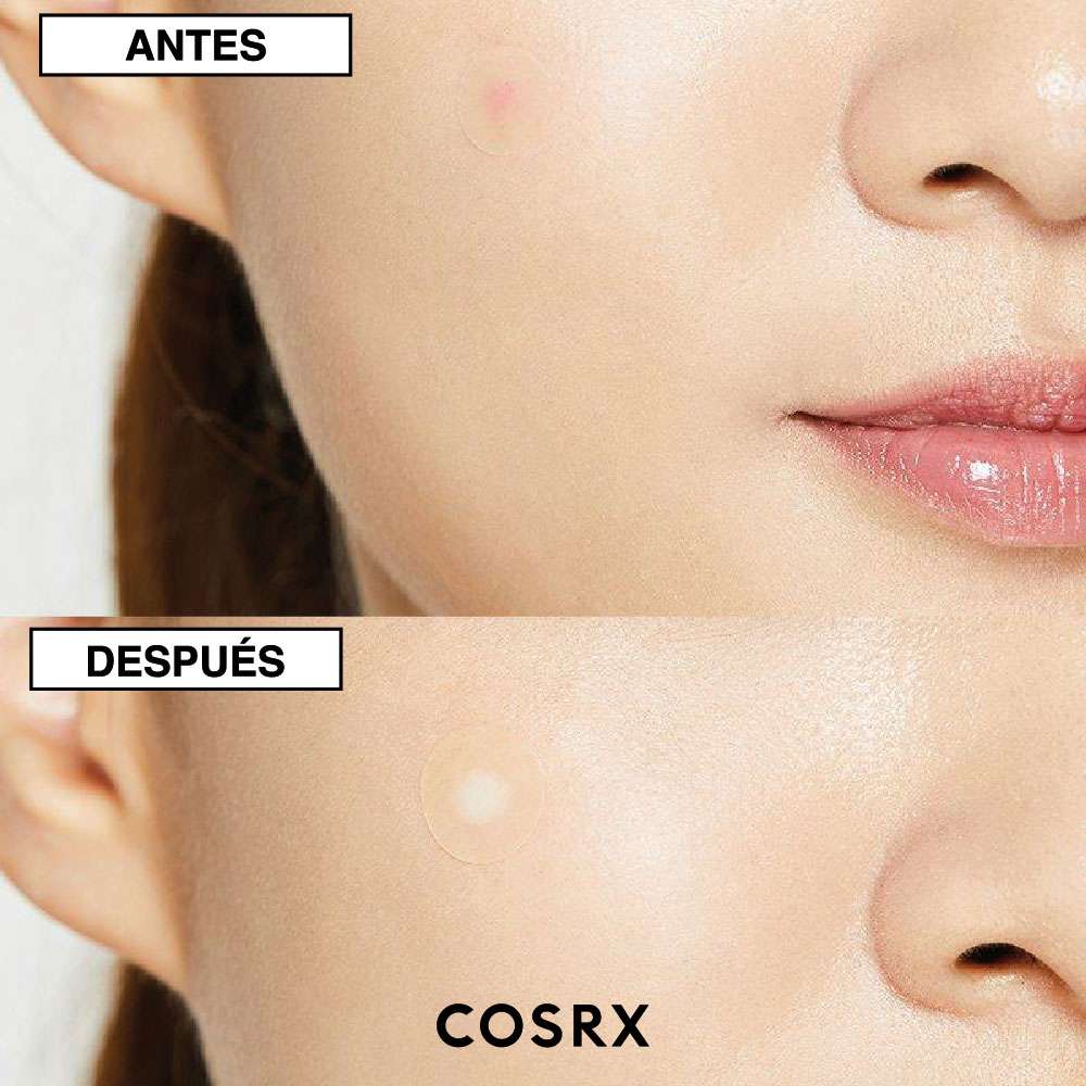 COSRX Master Patch Original X 24 Unds - Image 4