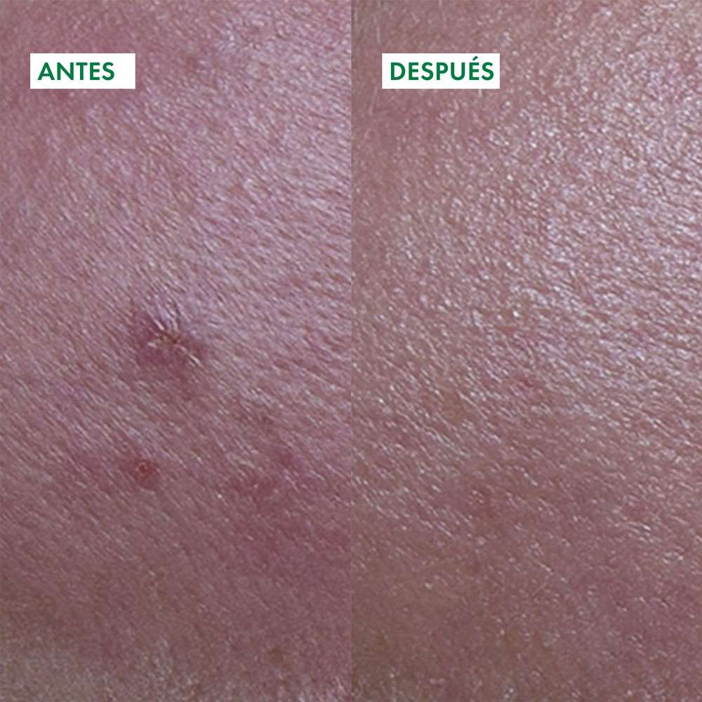 VICHY Capital Soleil UV Clear SPF 50+ x 40ml - Image 9